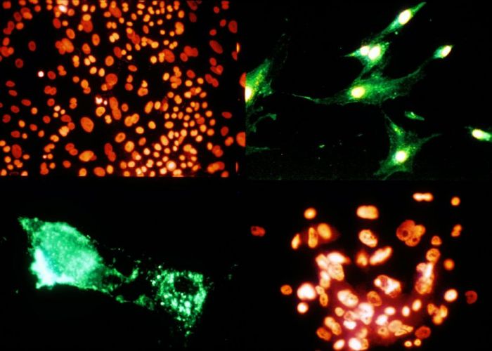 Pourquoi nos organes sont inégaux face au cancer ?