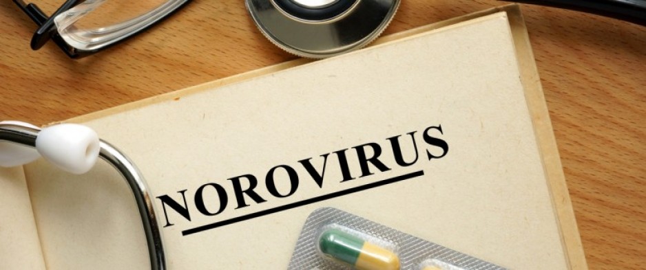 4 choses à savoir sur le norovirus, le virus de la gastro
