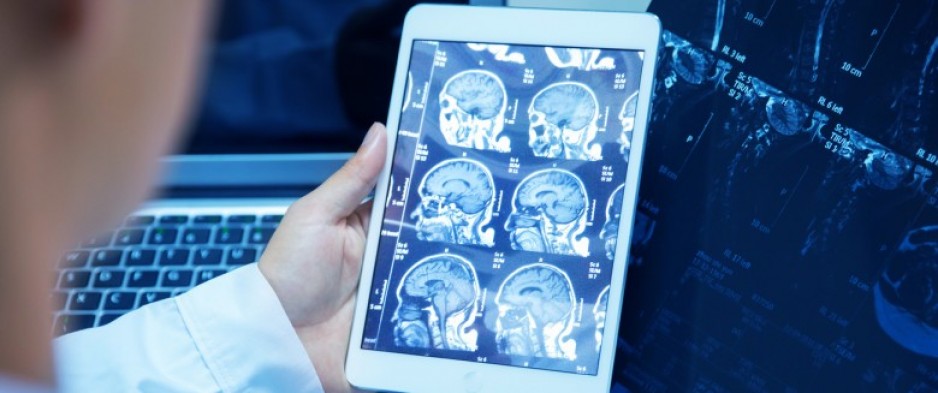 Cancer : les graisses influencent la propagation des métastases
