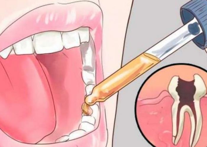 Mettez ceci dans votre bouche et les maux de dents disparaîtront en quelques secondes !