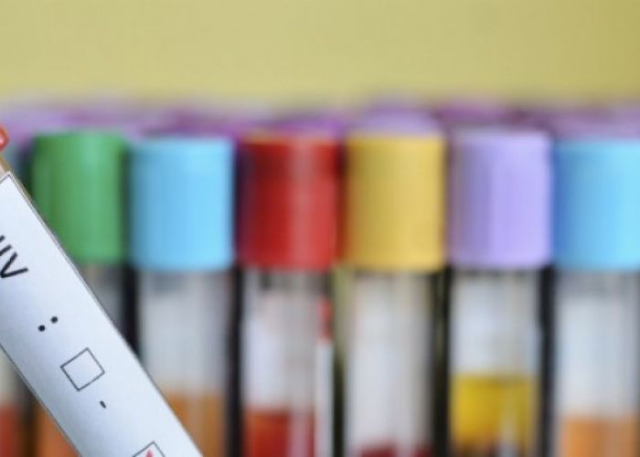 Journée mondiale de lutte contre le Sida : quelles sont les idées reçues les plus répandues ?