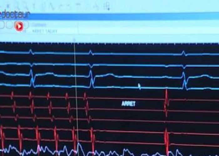 Une étude démontre que l’esprit fonctionne encore après que le corps ne donne aucun signe de vie