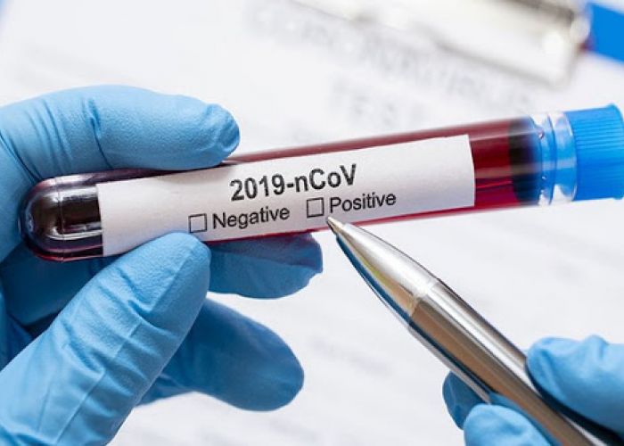 Coronavirus en Algérie (nouveau bilan) : 538 cas,11 décès, 416 guéris et 62 patients en soins intensifs 