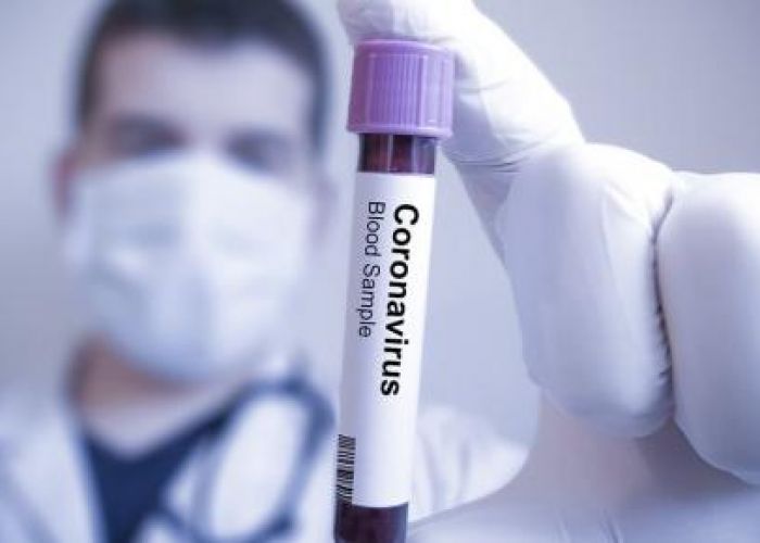 Coronavirus en Algérie (nouveau bilan) : 277 cas, 203 guérisons et 08 décès ces dernières 24h 