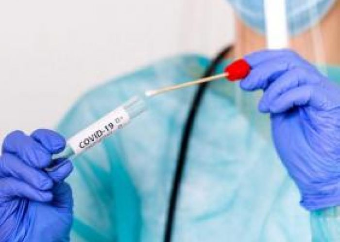 Coronavirus en Algérie (nouveau bilan) : 456 cas, 09 décès et 384 guérisons ces dernières 24 heures 