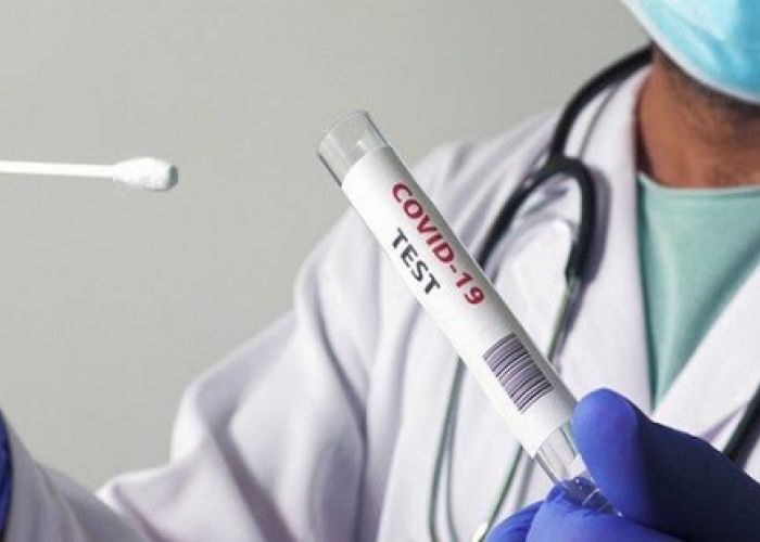 Coronavirus en Algérie (nouveau bilan) : 155 cas, 134 guérisons et 02 décès ces dernières 24 h
