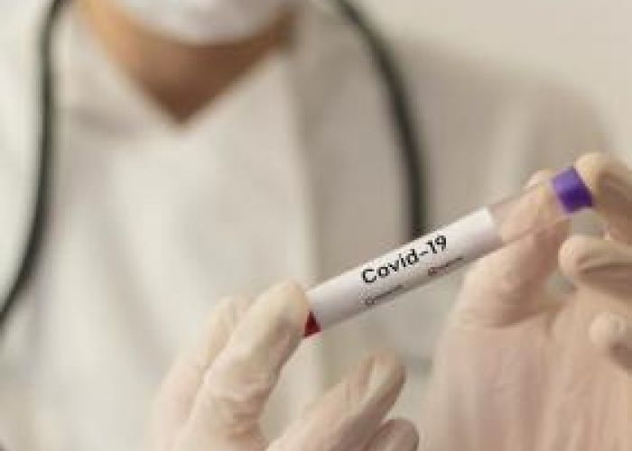 Coronavirus en Algérie (nouveau bilan) : 413 cas, 9 décès, 490 guéris et 54 patients en réanimation