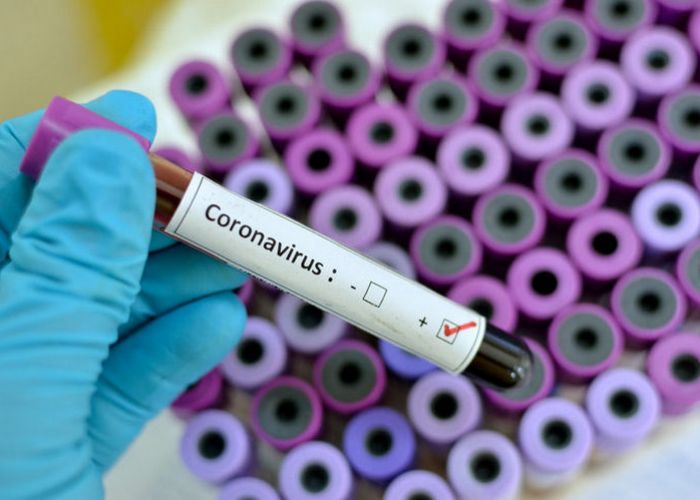Coronavirus : 156 nouveaux cas confirmés de Covid-19, 03 décès et 111 guérisons lors des dernières 24 heures, en Algérie