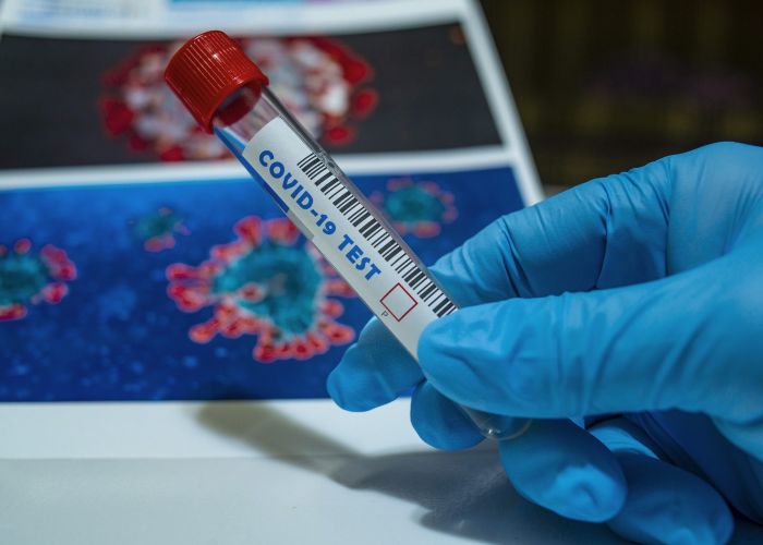 Coronavirus:176 nouveaux cas, 116 guérisons et 4 morts supplémentaires