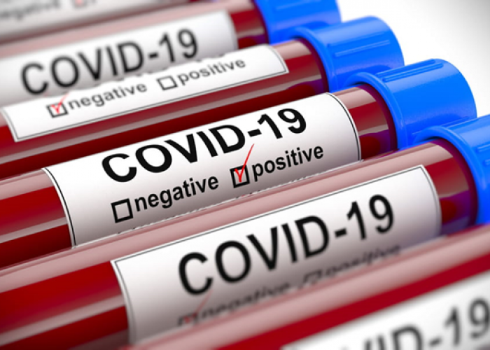  Covid-19 en Algérie : entre textes, paroles et réalités