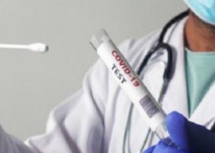 Coronavirus en Algérie (nouveau bilan) : 161 cas, 132 guérisons et 04 décès ces dernières 24h