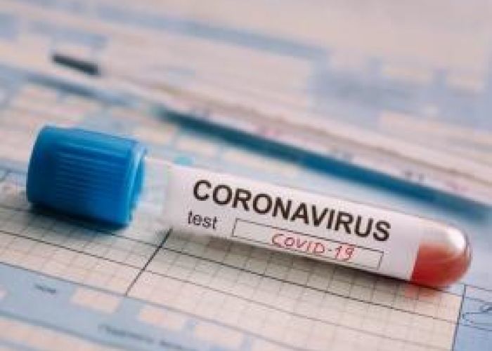 Coronavirus en Algérie (nouveau bilan) : 94 cas, 89 guérisons et 5 décès ces dernières 24h