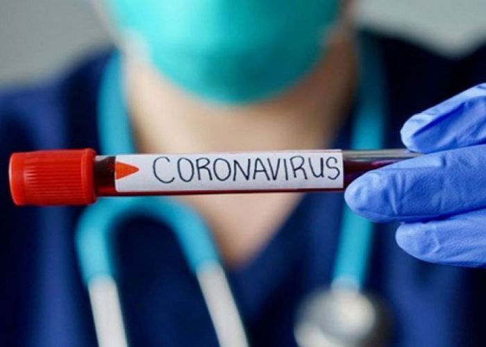 Coronavirus: 105 nouveaux cas, 02 décès et 93 guérisons sur les dernières vingt-quatre heures