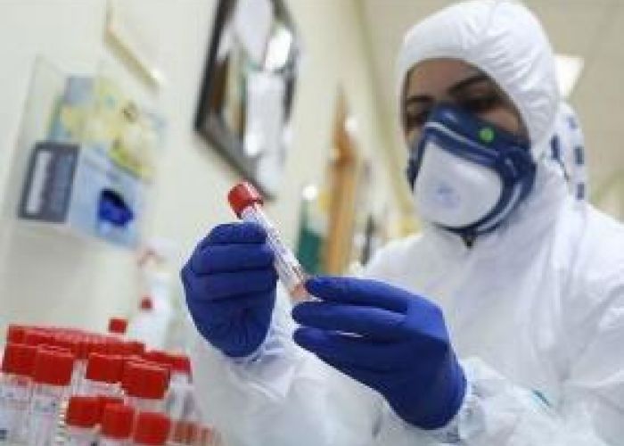 Coronavirus en Algérie (nouveau bilan) : 96 cas, 111 guérisons et 02 décès