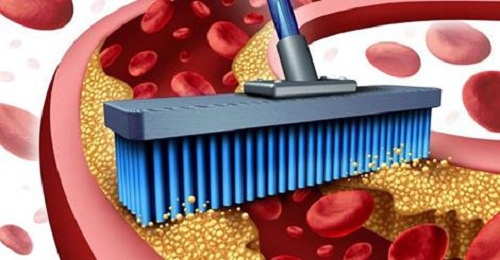 Neuf astuces pour purifier les artères