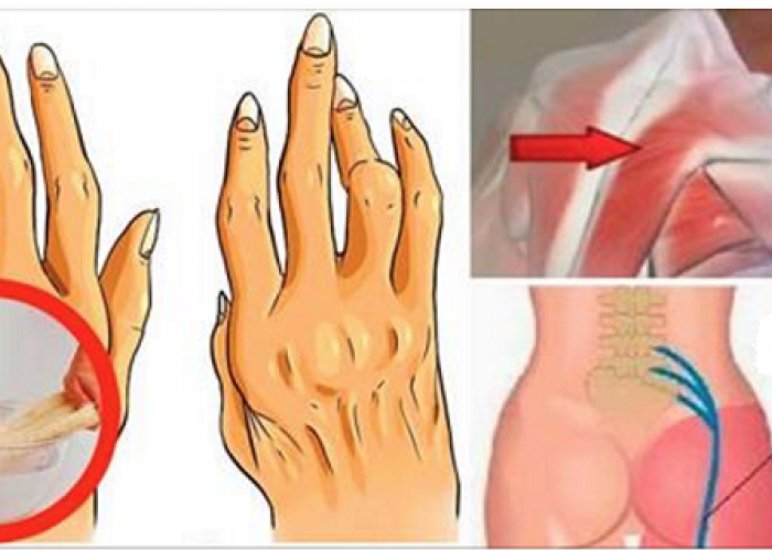 Une astuce géniale pour soulager l’arthrite, la douleur sciatique et le mal de dos