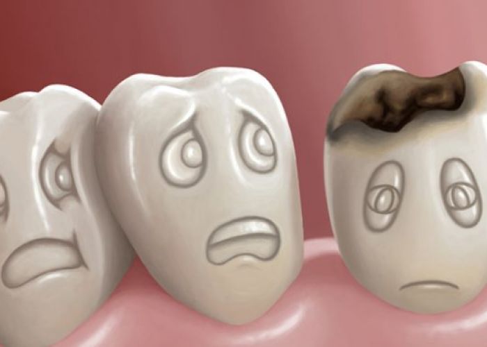 Les remèdes de grand-mères contre le mal de dents