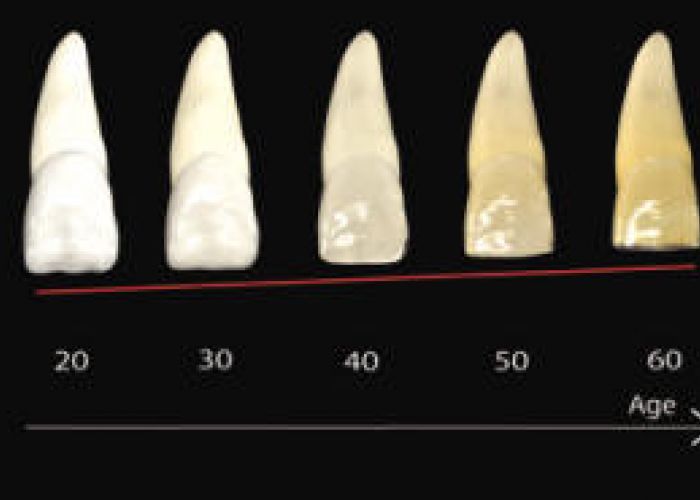 L’impact du vieillissement dentaire sur la santé mentale