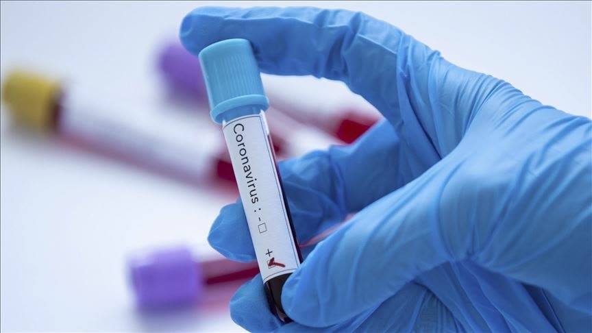 Coronavirus: 354 nouveaux cas, 8 morts et 242 cas de guérisons