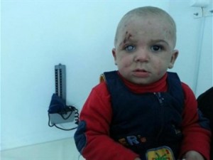 Syrie : enterré avec sa mère, il est retiré in extrémis de la tombe