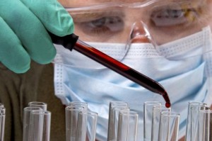 L’étrange malédiction des microbiologistes dans le monde