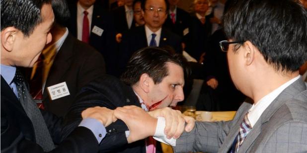 L'ambassadeur Américain à Séoul blessé lors d’une agression