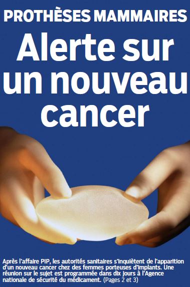 Des cas de cancer particulier seraient liés à des implants mammaires